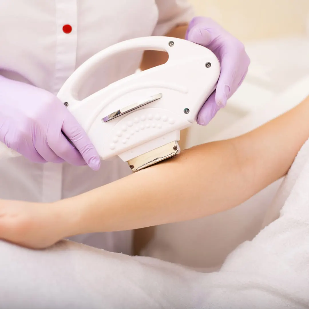 Laser skin procedure